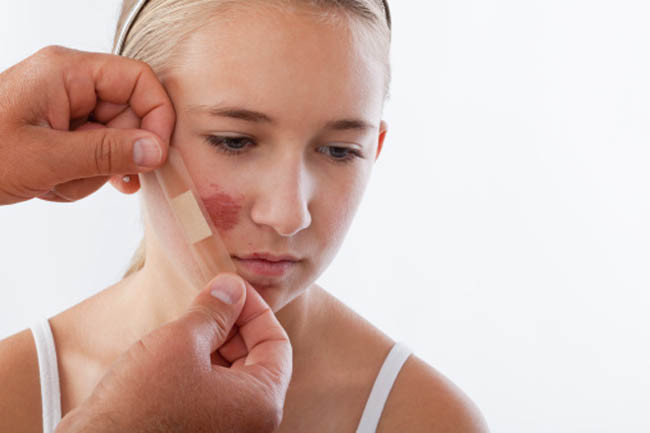 7 công dụng tuyệt vời để chăm sóc da từ quả lựu hình 7 7 cong dung tuyet voi de cham soc da tu qua luu hinh 7