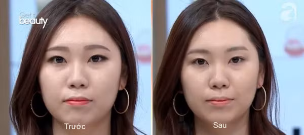 Mẹo hay ít ai biết khi dùng kem dưỡng mắt: Bôi theo hình chữ S vừa nâng cơ lại giúp khuôn mặt trẻ ra vài tuổi - Ảnh 5.