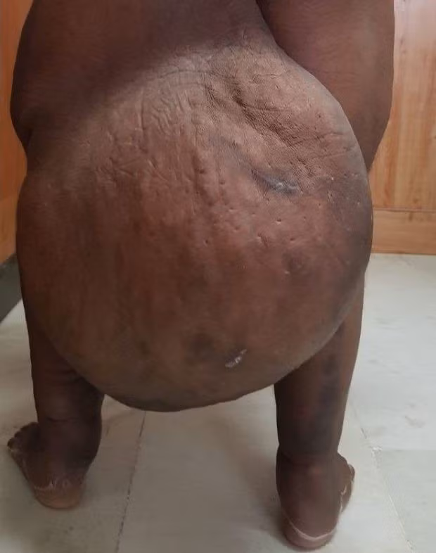 Cơ hội thay đổi số phận cho người nằm liệt giường sau một lần bị muỗi đốt ảnh 2