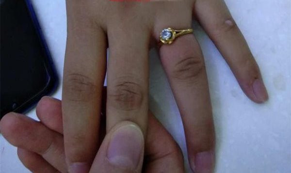 Bà mẹ trẻ chưa thể lên bàn mổ đẻ vì chiếc nhẫn cưới chật ních không tháo ra được.