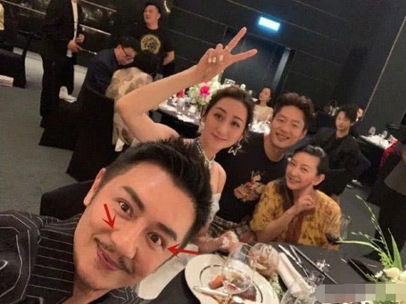 Đoàn Dự Trần Hạo Dân khiến nhiều người bất ngờ với diện mạo mới sau khi phẫu thuật, ai cũng bày tỏ sự tiếc nuối - Ảnh 2. Đoàn Dự Trần Hạo Dân khiến nhiều người bất ngờ với diện mạo mới sau khi phẫu thuật, ai cũng bày tỏ sự tiếc nuối - Ảnh 2.