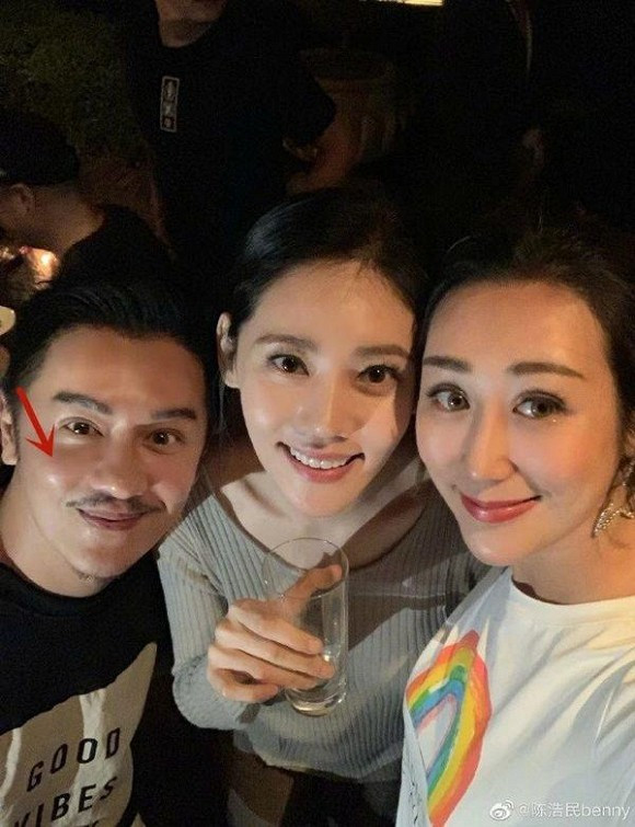 Đoàn Dự Trần Hạo Dân khiến nhiều người bất ngờ với diện mạo mới sau khi phẫu thuật, ai cũng bày tỏ sự tiếc nuối - Ảnh 3. Đoàn Dự Trần Hạo Dân khiến nhiều người bất ngờ với diện mạo mới sau khi phẫu thuật, ai cũng bày tỏ sự tiếc nuối - Ảnh 3.