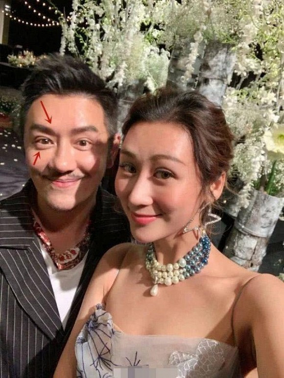 Đoàn Dự Trần Hạo Dân khiến nhiều người bất ngờ với diện mạo mới sau khi phẫu thuật, ai cũng bày tỏ sự tiếc nuối - Ảnh 4. Đoàn Dự Trần Hạo Dân khiến nhiều người bất ngờ với diện mạo mới sau khi phẫu thuật, ai cũng bày tỏ sự tiếc nuối - Ảnh 4.