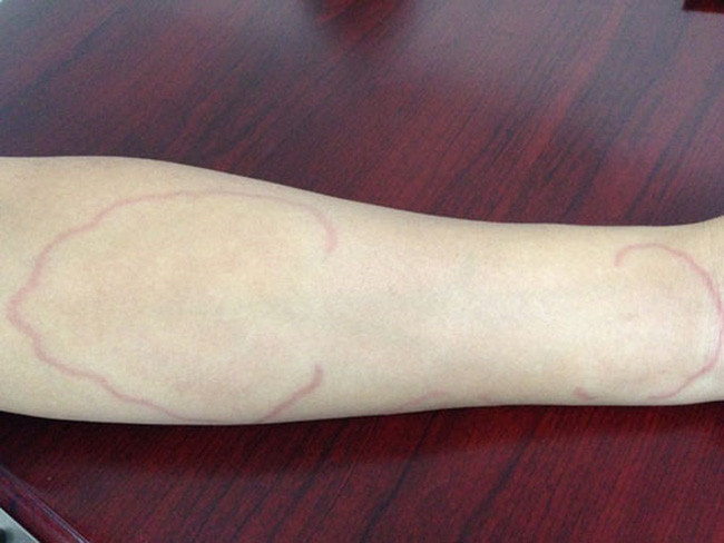 Dấu hiệu nhận biết những loại thịt tiềm ẩn nguy cơ nhiễm sán chẳng kém thịt lợn - Ảnh 4. Dấu hiệu nhận biết những loại thịt tiềm ẩn nguy cơ nhiễm sán chẳng kém thịt lợn - Ảnh 4.