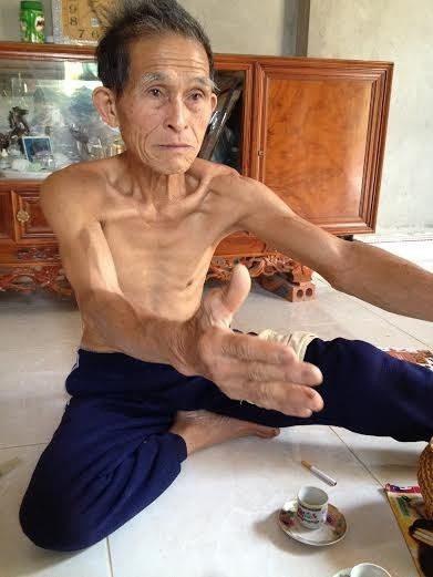 Dị nhân có cái bụng không đáy ảnh 3 Dị nhân có cái bụng không đáy ảnh 3