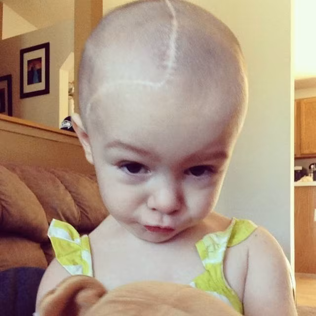 Thấy phần thóp trên đầu con trông bất thường, mẹ lo lắng và đành bất lực chấp nhận sự thật đau lòng đằng sau đấy - Ảnh 5.