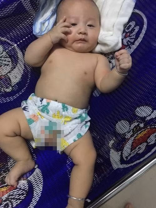  Lên cơn co giật rồi hôn mê, cô gái Yên Bái tỉnh dậy ngỡ ngàng phát hiện đã sinh con 