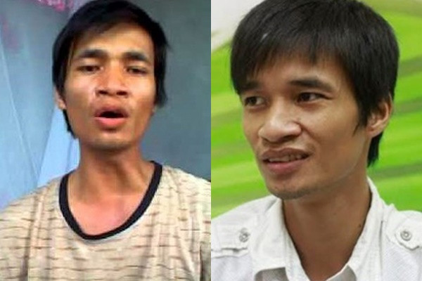 Lệ Rơi thời điểm đầu nổi tiếng là một anh chàng chân quê. Lệ Rơi thời điểm đầu nổi tiếng là một anh chàng chân quê.