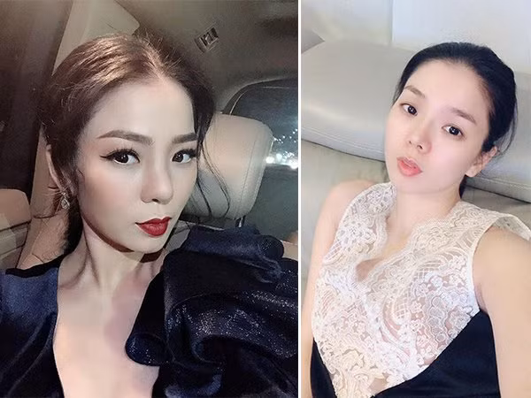 Lệ Quyên cách đây một thời gian đã phải gỡ bỏ sụn mũi khi đứng trước nguy cơ hoại tử. Diện mạo của nữ ca sĩ sau khi tháo sụn vẫn trông vô cùng xinh đẹp.