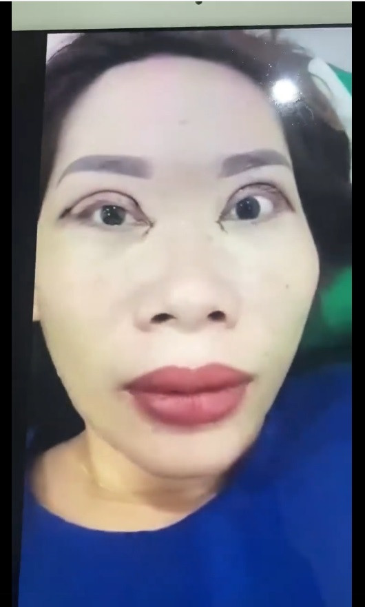 Pha cắt mí đi vào lòng đất: Dân mạng gọi đó là chết không nhắm được mắt-1