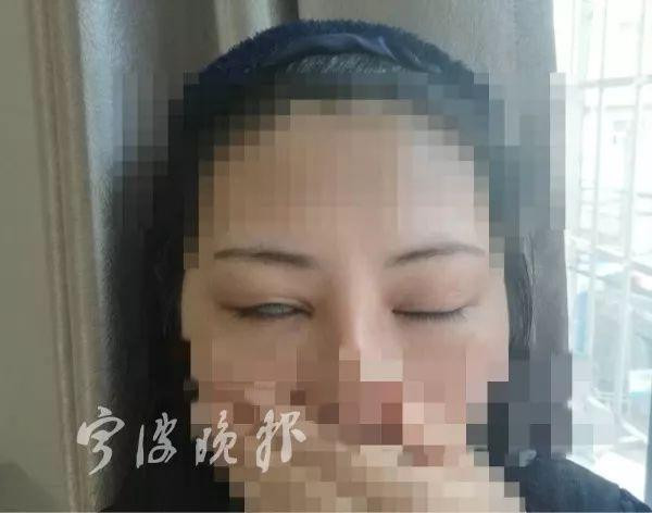 Pha cắt mí đi vào lòng đất: Dân mạng gọi đó là chết không nhắm được mắt-7