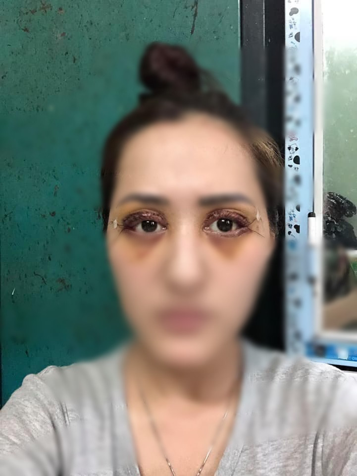 Pha cắt mí đi vào lòng đất: Dân mạng gọi đó là chết không nhắm được mắt-5