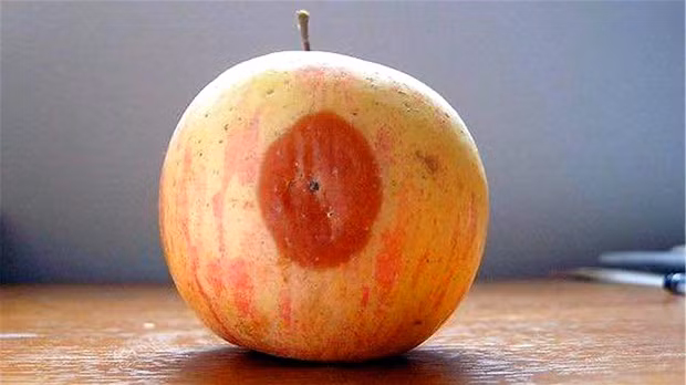 Chàng trai 33 tuổi không thuốc lá, rượu bia nhưng mắc ung thư gan giai đoạn cuối chỉ vì quá... tiết kiệm-2