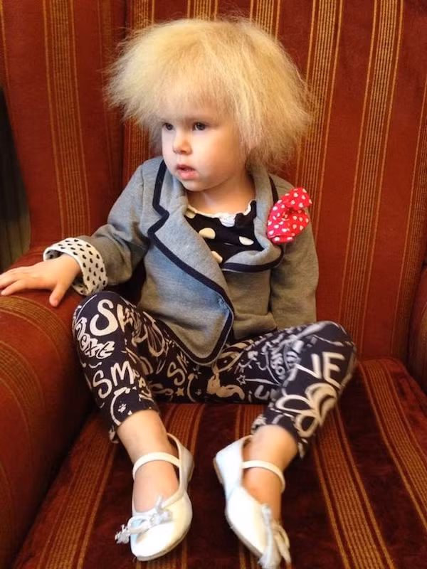 Bé gái sở hữu mái tóc kì lạ khiến mẹ khổ sở vì không thể chải theo ý muốn, diện mạo khi lớn lên ai cũng bất ngờ-1