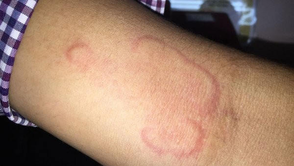 Thường xuyên chăm hoa, người phụ nữ hốt hoảng vì ho khạc ra giun lúc nhúc Thường xuyên chăm hoa, người phụ nữ hốt hoảng vì ho khạc ra giun lúc nhúc