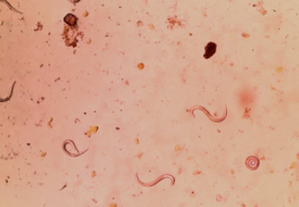 Thường xuyên chăm hoa, người phụ nữ hốt hoảng vì ho khạc ra giun lúc nhúc Thường xuyên chăm hoa, người phụ nữ hốt hoảng vì ho khạc ra giun lúc nhúc