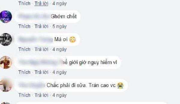 Sửa mũi cắt môi “xưa rồi”, chị em bây giờ rủ nhau làm đẹp kinh dị thế này ảnh 6 Sửa mũi cắt môi đã là gì, chị em bây giờ còn rủ nhau đi cắt da đầu để...-6