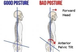 Uốn cong cột sống quá mức thể gây ra những tác hại khôn lường lên sự hoạt động của cột sống. 