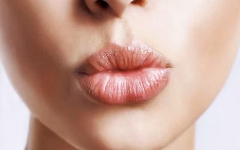 10 nguyen nhan khien doi moi nut ne hinh 9