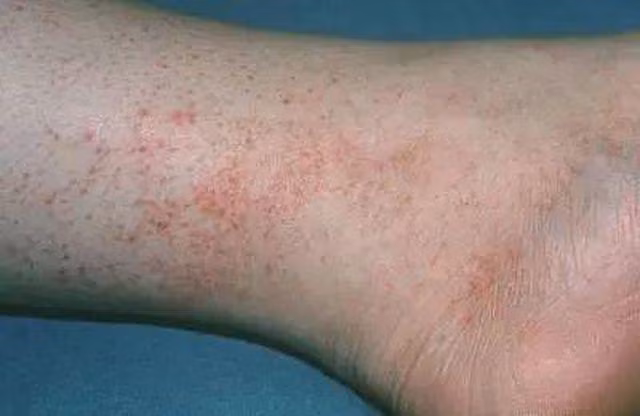 co gai 28 tuoi suyt mat mang vi tuong man do o chan la di ung nhung su that la... - 1