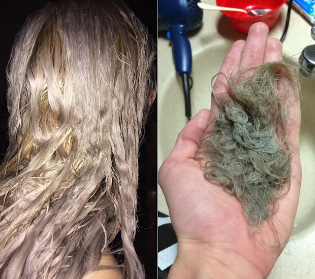Nổi da gà với tình cảnh cô gái tẩy tóc bị rụng nguyên cả mảng đến mức hói đầu-6