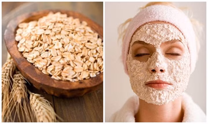 5 loại mặt nạ siêu rẻ trị mụn ẩn cực hiệu quả