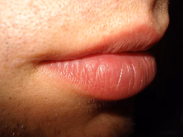 bo tui 9 bi kip giup lan moi hong luon xinh tuoi mem mai hinh 9