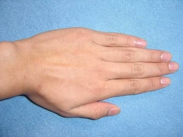 Người sở hữu bàn tay này thường sau tuổi trung niên mới được hưởng cuộc sống sung túc.