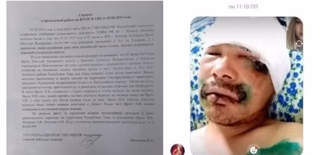 Thoát chết trong gang tấc nhờ … cắn vào lưỡi gấu - 2