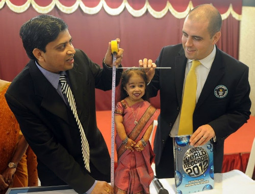 Amge 24 tuổi chỉ cao 63 cm. Amge 24 tuổi chỉ cao 63cm. Ảnh: DailyMirror