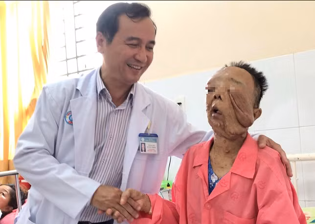 Một phụ nữ mắc bướu sợi thần kinh hiếm gặp