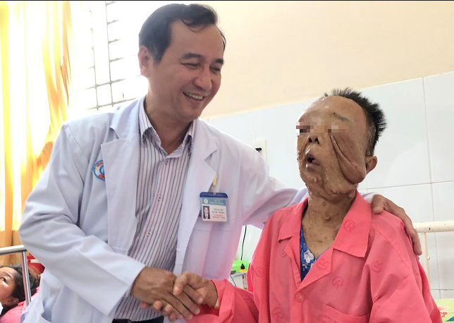 Một phụ nữ mắc bướu sợi thần kinh hiếm gặp