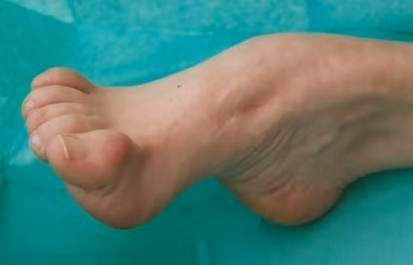 Gia tộc Samsung đeo bám mãi một bệnh di truyền đáng sợ