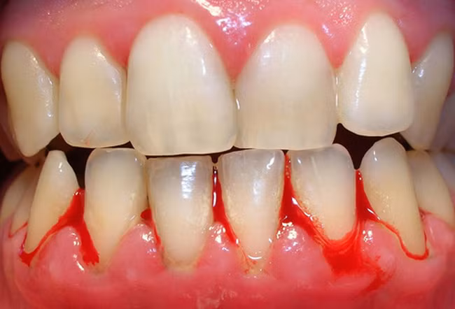 Xuất hiện những dấu hiệu này cho thấy bạn đang bị stress nghiêm trọng, cần khắc phục ngay bằng một chế độ ăn lành mạnh - Ảnh 2.