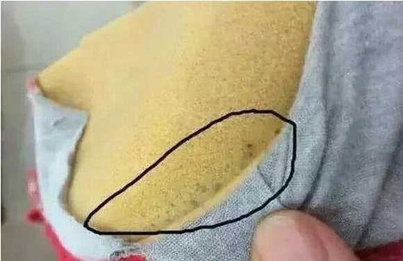 Tò mò cắt áo lót mặc 4 năm ra xem thử, người phụ nữ giật mình kinh hãi