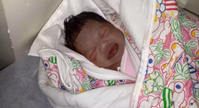 Bức ảnh em bé thâm tím khiến nhiều người rơi lệ.