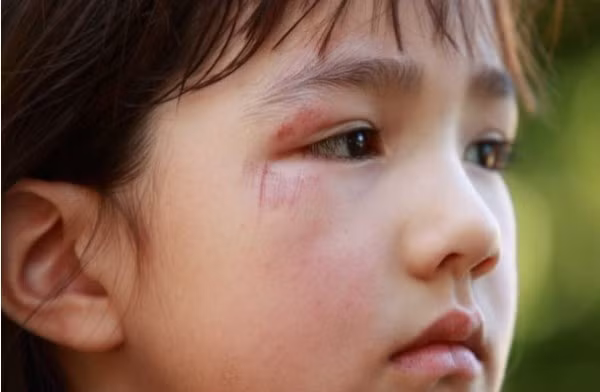 Ảnh: iStock 6 cách nhận biết con bị bắt nạt tại trường