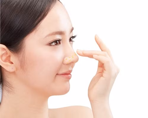 7 bước chăm sóc đơn giản để có sống mũi cao, thẳng đẹp sau ngày phẫu thuật