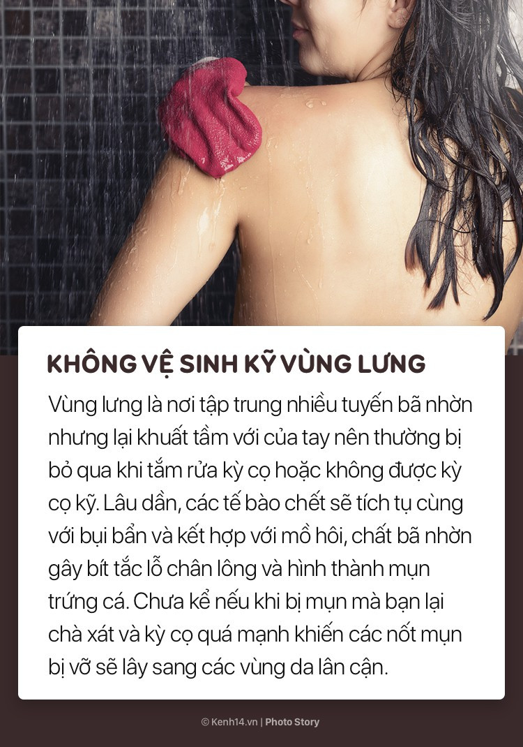 Đừng hỏi vì sao lưng nổi nhiều mụn nếu bạn thường có những thói quen này - Ảnh 1. Đừng hỏi vì sao lưng nổi nhiều mụn nếu bạn thường có những thói quen này - Ảnh 1.