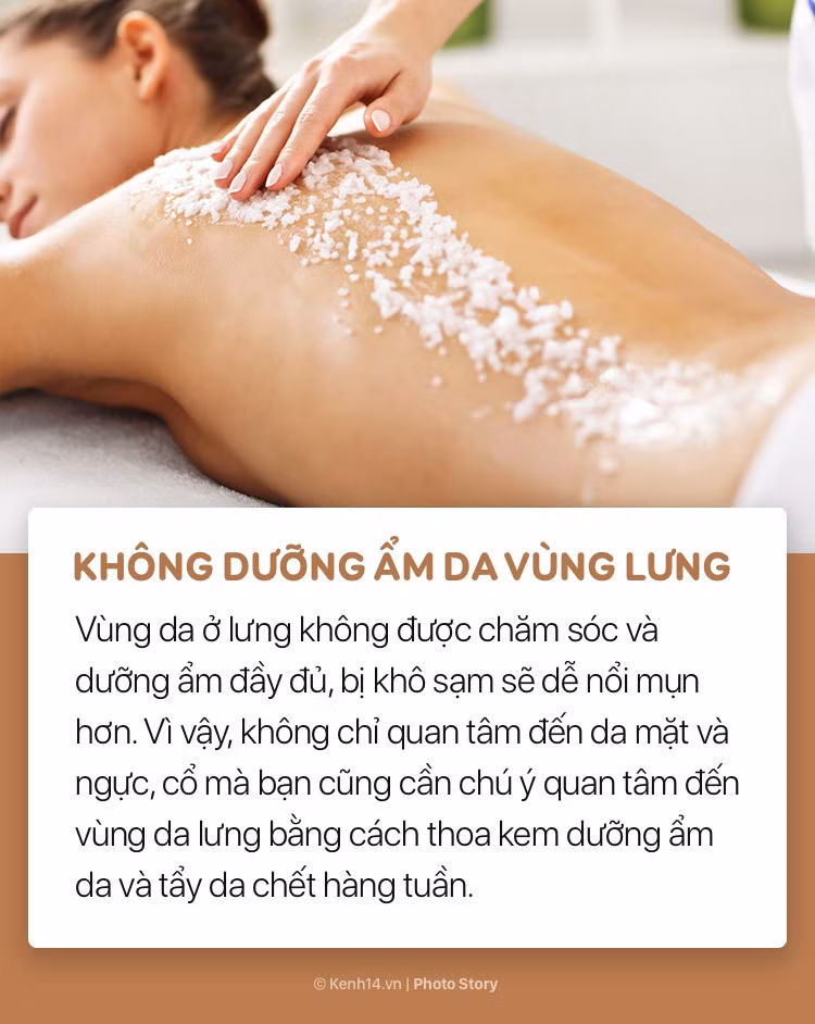 Đừng hỏi vì sao lưng nổi nhiều mụn nếu bạn thường có những thói quen này - Ảnh 11.