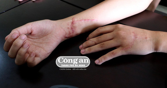 Suy nghĩ nông cạn của gã em chồng trước khi sát hại chị dâu