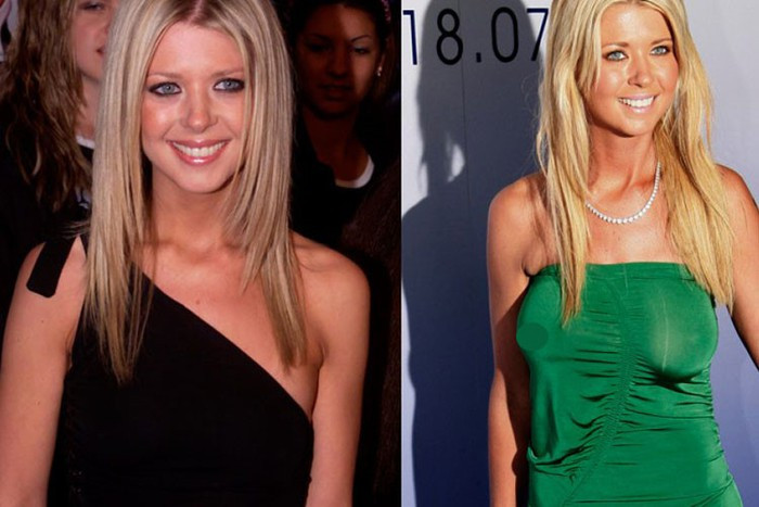 Nhiều sao Hollywood bị nổ túi ngực kinh hoàng như Ivy Trần ảnh 6 Nhiều sao Hollywood bị nổ túi ngực kinh hoàng như Ivy Trần ảnh 6