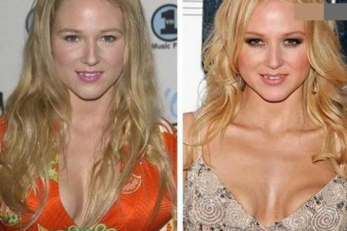 Nhiều sao Hollywood bị nổ túi ngực kinh hoàng như Ivy Trần ảnh 11 Nhiều sao Hollywood bị nổ túi ngực kinh hoàng như Ivy Trần ảnh 11