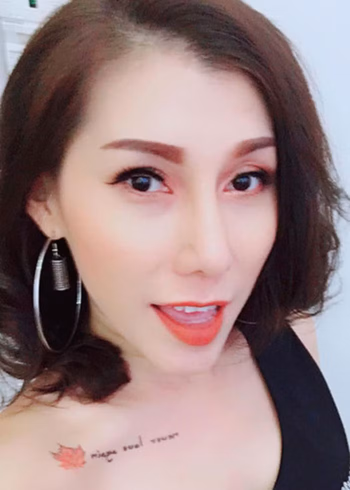 Nhiều sao Hollywood bị nổ túi ngực kinh hoàng như Ivy Trần ảnh 1