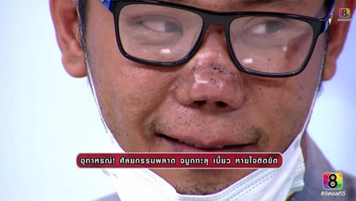 Khóc thét những ca sửa mũi thảm họa