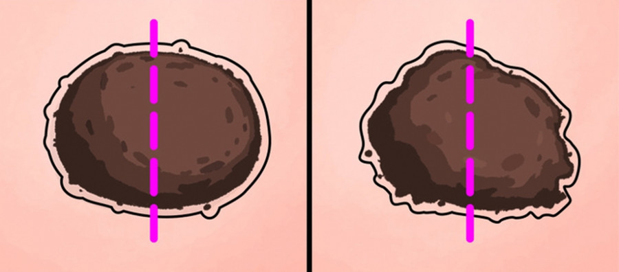 Nhung kieu not ruoi to cao ban dang bi benh, can di kham som hinh anh 1