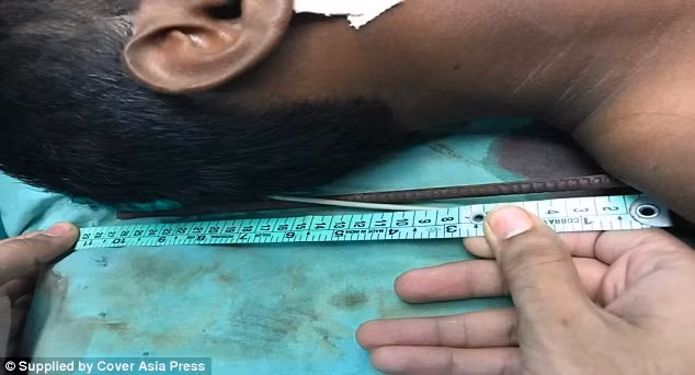 Thanh thép xuyên qua cổ Salim