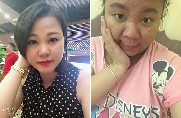 Mặt mụn, da xạm đi khiến mẹ chẳng còn nét rạng rỡ, tươi trẻ. Mặt mụn, da xạm đi khiến mẹ chẳng còn nét rạng rỡ, tươi trẻ.