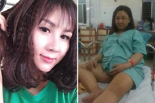 Cười ra nước mắt loạt ảnh “trước và sau khi có bầu” của mẹ bỉm sữa