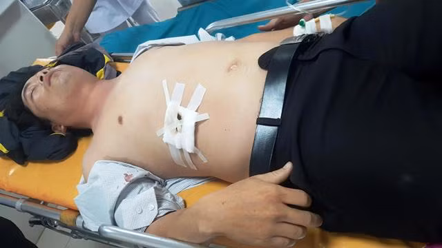 Thầy T bị đâm vết thương khá nặng, thấu gan. Ảnh: VNN.